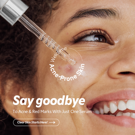 Azelaic Acid 12% Serum - Lightweight Dark Spot Reducer, Gentle Breakout care, For Uneven skin tone, Redness, Red Marks and Acne
