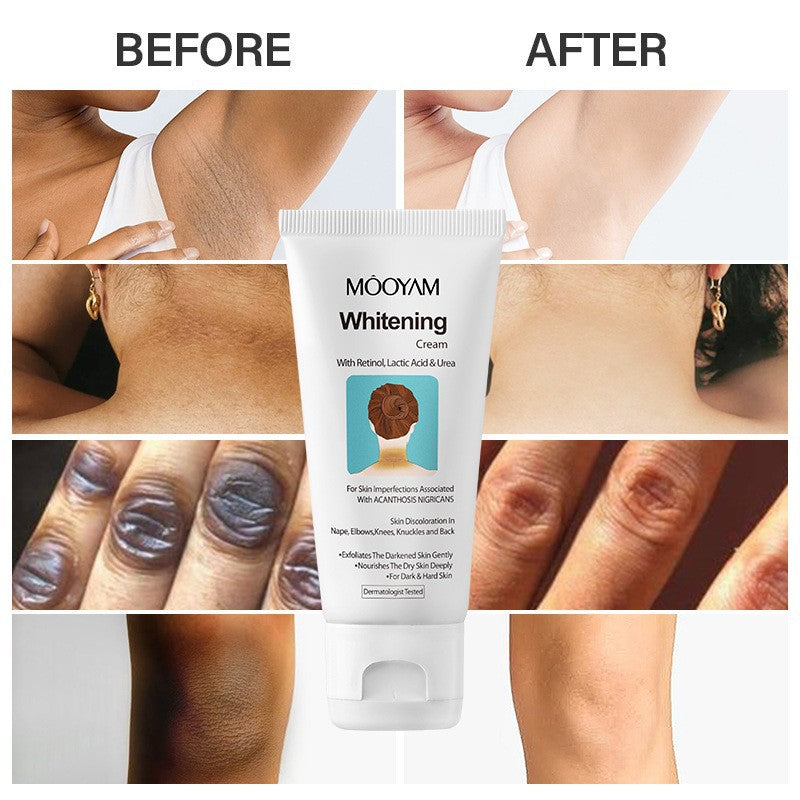 Wrinkle-Fighting, Neck Beautifying, Neckline Wrinkle, Dark Neck Care Cream